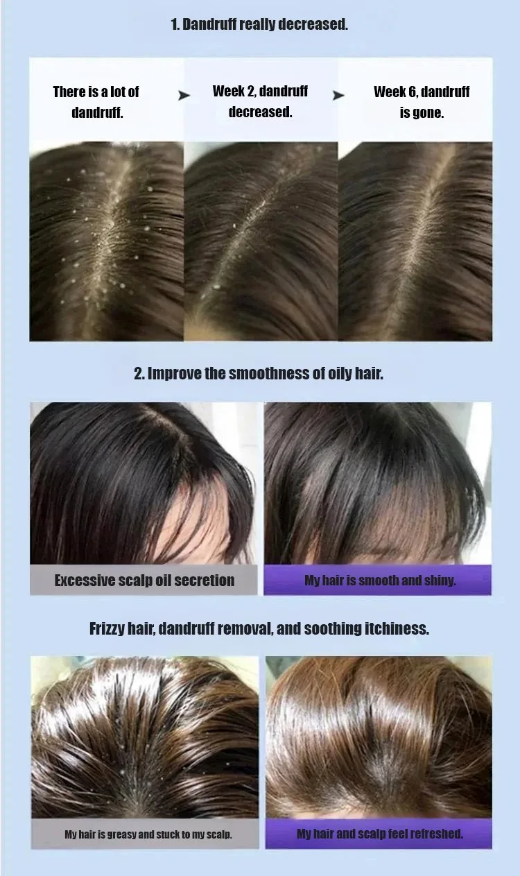 Deep Moisture Refreshing Dandruff Control Shampoo