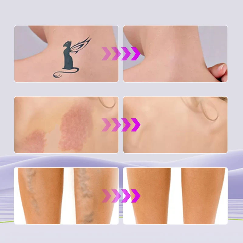 💜Limited Sale 50% OFF 💜Waterproof Tattoo Cover Up Concealer - Image 6