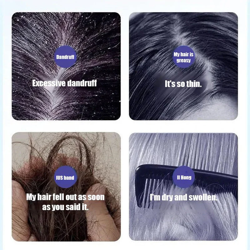 Deep Moisture Refreshing Dandruff Control Shampoo - Image 2