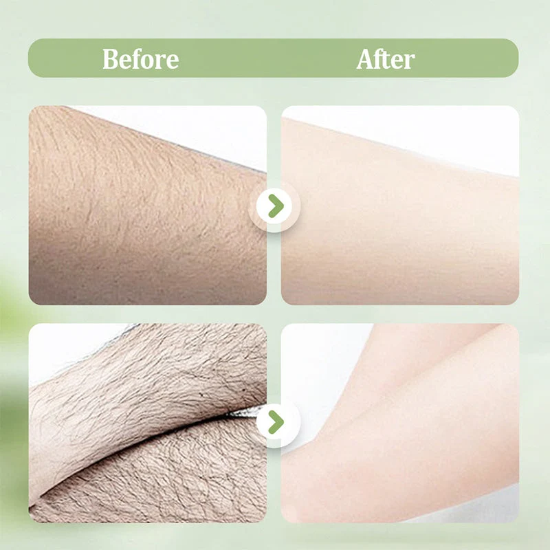 Gentle and Non-Irritating Hair Removal Cream - Image 6