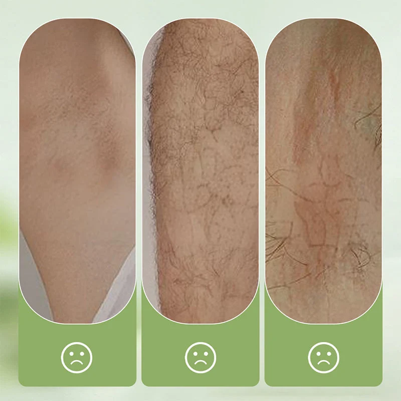 Gentle and Non-Irritating Hair Removal Cream - Image 5